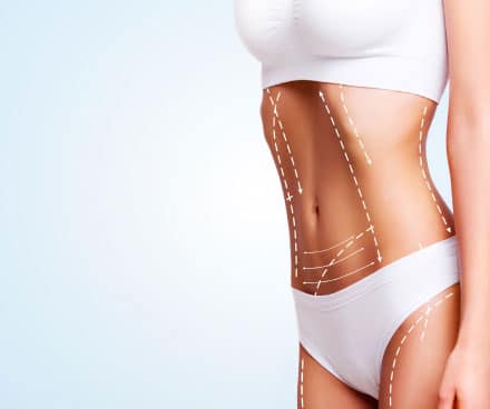 reverse abdominoplasty