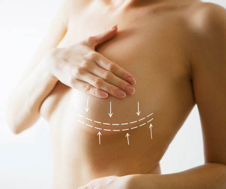 breast augmentation with lift
